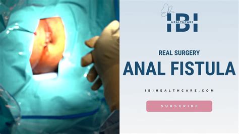 Anal fissure: Symptoms and their treatment from ointment to surgery